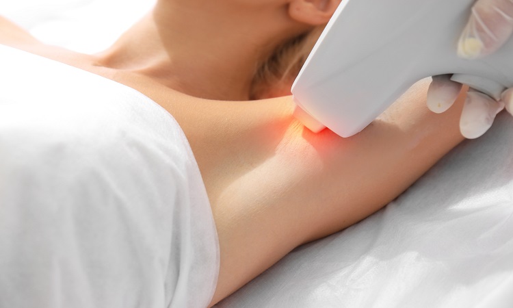 Έφηβοι και laser αποτρίχωση